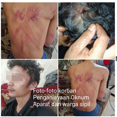 Diduga Oknum TNI Terlibat Penculikan dan Penganiayaan Krisman Priyanto Mendrofa di Medan